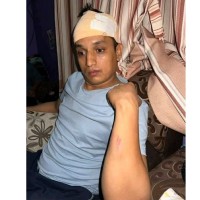 अज्ञात समूहद्वारा कुटिए रास्वपा नेता बदन भण्डारी Image